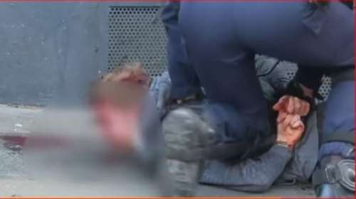 Οργή στη Γαλλία για τον ξυλοδαρμό διαδηλωτή- Ηταν πεσμένος και αιμόφυρτος