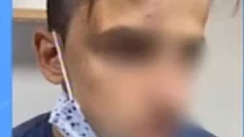 Γαλάτσι: Σοκάρει νέα υπόθεση ξυλοδαρμού ανηλίκου - 20 άτομα χτυπούσαν έναν 17χρονο