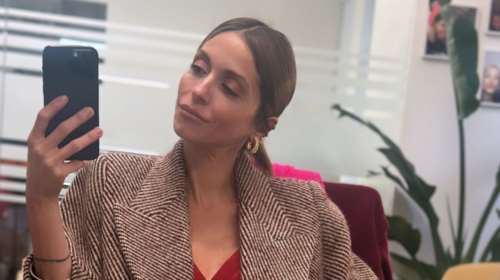 Σοφία Καρβέλα: Η ενέσιμη θεραπεία που έκανε στο πρόσωπό της για λάμψη και αναζωογόνηση