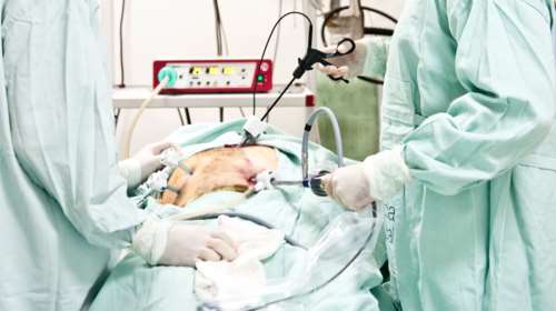 Τι συμβαίνει με την κολονοσκόπηση; "Στον αέρα" η έρευνα ότι δήθεν δεν είναι αποτελεσματική στην πρόληψη του παχέως εντέρου