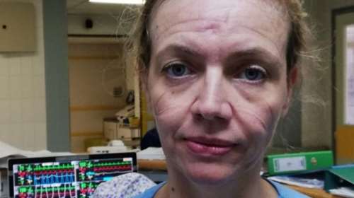 Ελληνίδα γιατρός συγκλονίζει με τα σημάδια της μάσκας στο πρόσωπο: &quot;Γίνε ήρωας κι εσύ, φόρεσέ τη λίγες ώρες τη μέρα&quot;