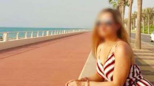 Επίθεση με βιτριόλι: Η 34χρονη έχει &quot;φρικτό χημικό έγκαυμα&quot; - &quot;Ούρλιαζε από τους πόνους&quot;, λέει ο γιατρός της