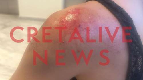 Ασύλληπτες σκηνές στην Κρήτη: Φωτογράφισε κρυφά τα οπίσθιά της, τη χτύπησε με μηχανάκι και την έσυρε στο οδόστρωμα