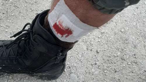 Έκρυθμη η κατάσταση στη Λέσβο: Αστυνομικός τραυματίστηκε από σκάγια