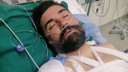 Σαλαμίνα - Ξυλοδαρμός διασώστη του ΕΚΑΒ: Οι φωτογραφίες και η συγκλονιστική ανάρτησή του