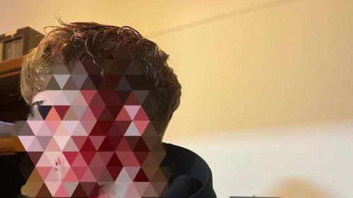 Θεσσαλονίκη: Σοκάρει η εικόνα του 16χρονου από την επίθεση με σωλήνα – &quot;Ήταν μέσα στα αίματα&quot;