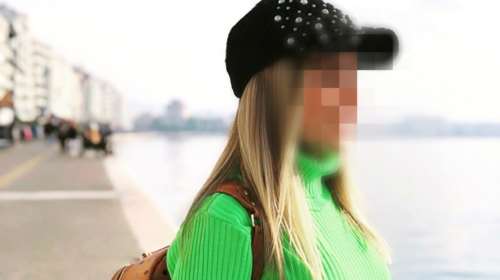 Επίθεση με βιτριόλι: Σφίγγει ο κλοιός γύρω από τη δράστρια - Θα δείξουν φωτογραφίες των υπόπτων στην 34χρονη