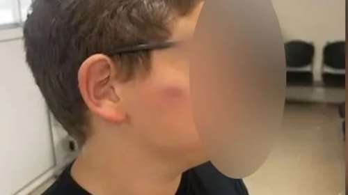 Θεσσαλονίκη: 11χρονος ξυλοκοπήθηκε από συμμαθητές του -&quot;Θύμα bullying εδώ και 3 χρόνια&quot;