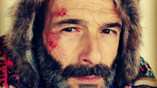 Θανάσης Ευθυμιάδης: Ατύχημα με το ποδήλατό του - Χτύπησε στο πρόσωπο