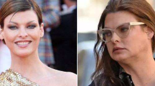 Λίντα Εβαντζελίστα: &quot;Εμεινα μόνιμα παραμορφωμένη μετά από αισθητική επέμβαση&quot; - Σοκ στον χώρο της μόδας