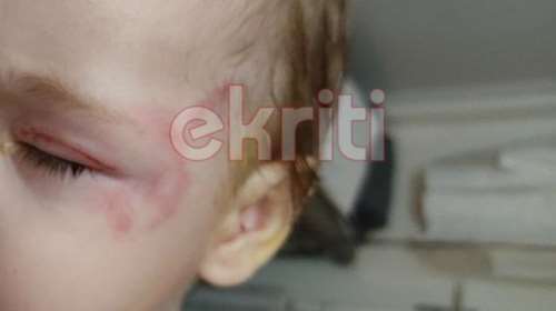 Κρήτη: Τι απαντά η ιδιοκτήτρια του σκύλου που δάγκωσε το βρέφος στην Αμμουδάρα