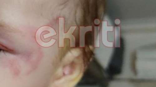 Κρήτη: Περιγραφή σοκ του πατέρα του βρέφους για την επίθεση από λυκόσκυλο - &quot;Χύμηξε πάνω στο παιδί να του βγάλει τα μάτια&quot;