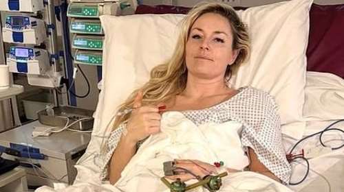 Λίντσεϊ Βον: "Μπορεί να ακρωτηριαστεί το πόδι της", λέει χειρουργός μετά τον τραυματισμό στους Ολυμπιακούς