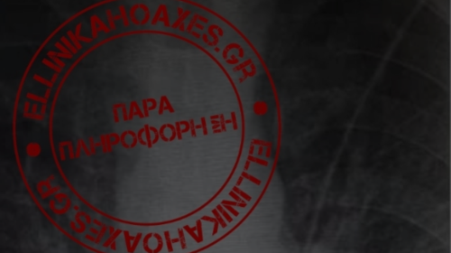 Ελληνικά Hoaxes: Fake news οι δήθεν &quot;ακτινογραφίες σοκ&quot; ασθενούς με κορονοϊό - Tι συνέβη με ανάρτηση γιατρού