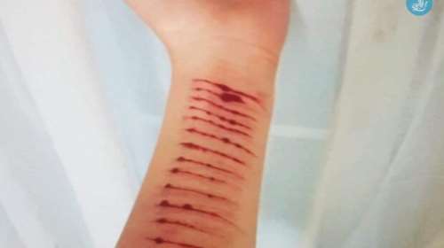 Σοκ στην Ρόδο: Αποπλάνησε 12χρονη μέσω του ίντερνετ για να του στείλει γυμνές φωτογραφίες και να αυτοτραυματιστεί