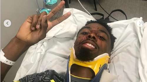 Εξιτήριο για τον Γκόμες της Λιλ μετά τον τραυματισμό του:&quot; Θυμίστε μου να μην πηδήξω για άλλες κεφαλιές&quot;