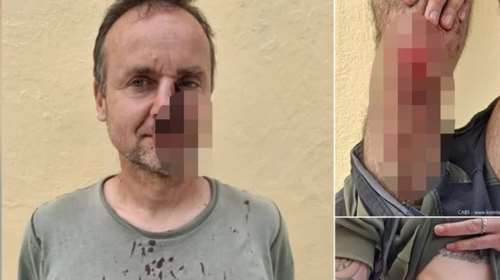 Ζάκυνθος: Άγριο ξύλο λαθροκυνηγών σε ορνιθολόγους- Τους έστειλαν στο νοσοκομείο με βαριά τραύματα