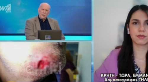 Απίστευτο περιστατικό στην Κρήτη: Δάγκωσε αστυνομικό που του έκανε έλεγχο - &quot;Μού έκοψε κομμάτι από το πρόσωπο&quot;