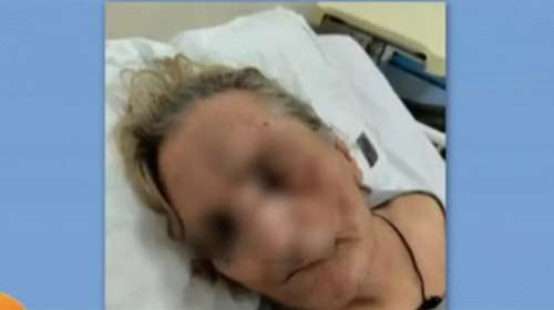 Πρωτοφανές: Ηλικιωμένη έπεσε θύμα ξυλοδαρμού από αποκλειστική νοσοκόμα στο Τζάνειο - Τι καταγγέλλει η κόρη της