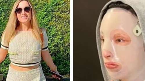 Επίθεση με βιτριόλι: &quot;Επίπονο, αλλά θα πάω στο δικαστήριο&quot;, λέει η Ιωάννα