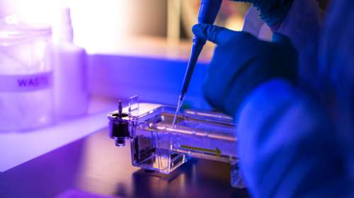 Καθηγήτρια Γενετικής για θάνατο των παιδιών στην Πάτρα: "Υπάρχουν τεχνικής φύσεως προβλήματα στην έρευνα"