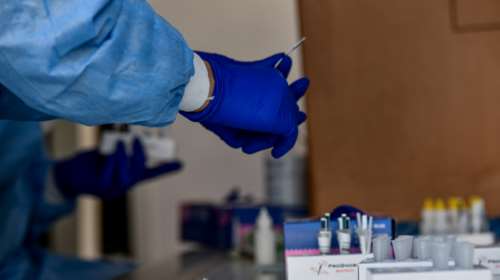 Κορονοϊός: Και όμως η Deltacron υπάρχει και εξαπλώνεται διαρκώς - Τι σημαίνει η νέα μετάλλαξη