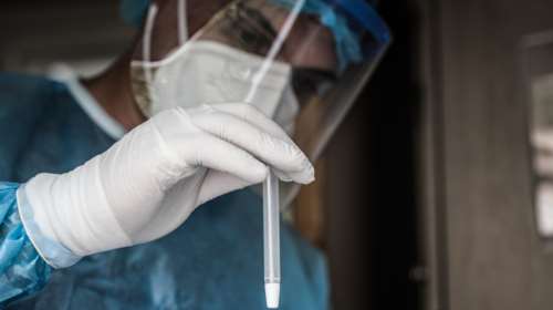 Κορονοϊός: Μειώθηκαν στα 693 τα νέα κρούσματα - 85 θάνατοι το τελευταίο 24ωρο - 552 οι διασωληνωμένοι