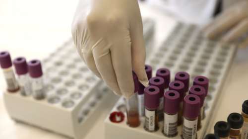 Κορονοϊός: Η σχέση της ομάδας αίματος με τη μόλυνση - Ποιοι κινδυνεύουν περισσότερο