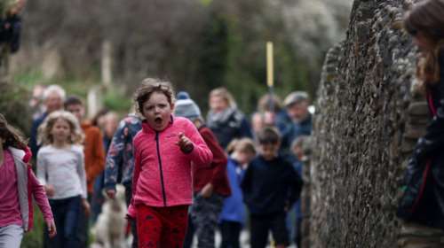 Τι είναι η οξεία ηπατίτιδα - Γιατί χτύπησε ξαφνικά παγκόσμιος συναγερμός για τα περιστατικά σε παιδιά