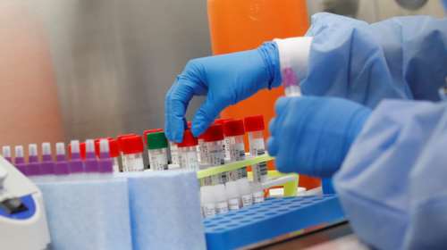 Κορονοϊός: Πόσο διαρκεί η ανοσία και πόσο ισχυρή είναι - Η ανάρτηση του Ηλία Μόσιαλου