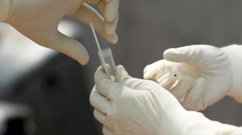 Νέα μελέτη: Ολλανδοί επιστήμονες έφτιαξαν ειδικά αντισώματα στο εργαστήριο κατά του κορονοϊού