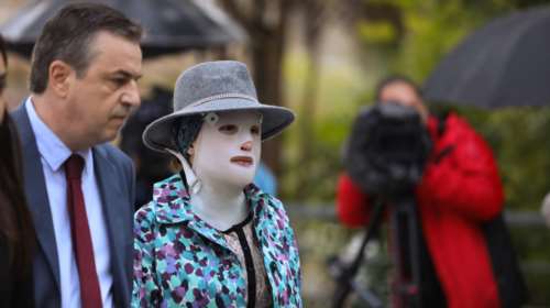 Επίθεση με βιτριόλι - Ιατροδικαστής: Είναι εκπληκτικό το πώς η Ιωάννα κατάφερε και γλίτωσε