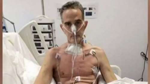 Συγκλονίζει πρωταθλητής μπόντι μπίλντινγκ για τον εφιάλτη με τον κορονοϊό - Εμεινε 2 μήνες στη ΜΕΘ, έχασε 42 κιλά [βίντεο]