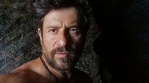 Αλέξης Γεωργούλης: Ατύχημα για τον ευρωβουλευτή - Το πολύωρο χειρουργείο μετά από σοβαρό τραυματισμό σε αναρρίχηση στον Όλυμπο [Εικόνα]