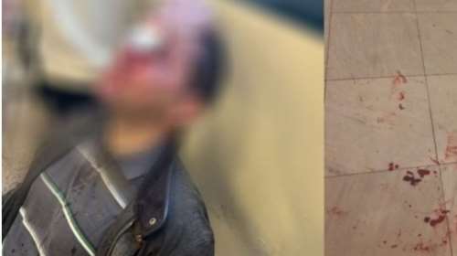 Επίθεση στη Νομική: 29χρονη γιατρός και τελειόφοιτος νομικής μεταξύ των 7 συλληφθέντων - Το ποινικό παρελθόν τους