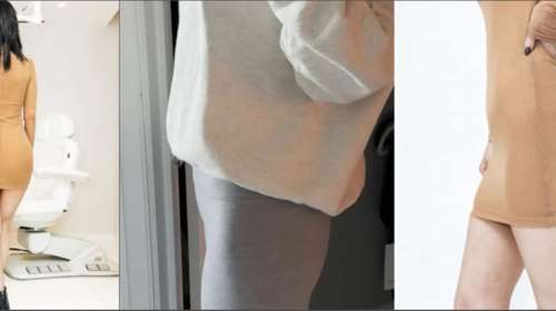 ΗΠΑ: Χάνουν βάρος με Ozempic και μετά φτιάχνουν γλουτούς με ενέσεις λίπους από πτώματα - Για το τέλειο σώμα