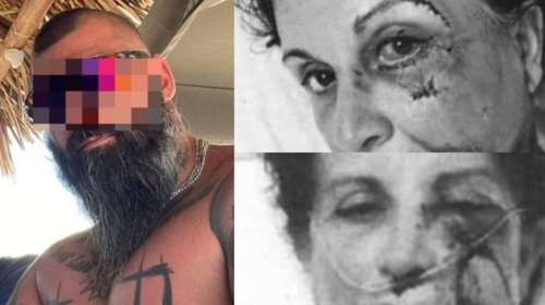 Ξυλοδαρμός στην Αίγινα: &quot;Φουσκωτοί&quot; μπράβοι με τατουάζ... Μίκυ Μάους παραλίγο να σκοτώσουν την ξενοδόχο και τον γιο της