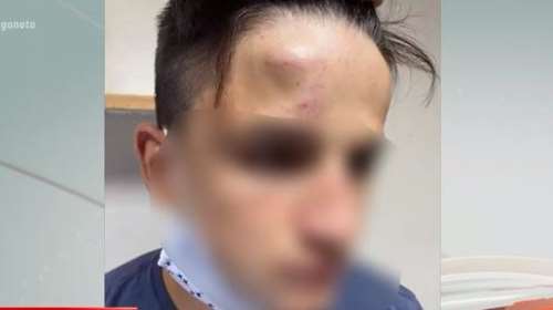 Γαλάτσι: Τέσσερις συλλήψεις για τον ξυλοδαρμό 17χρονου από 20 ανηλίκους