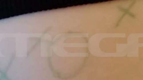 Βόλος: Η τρίλιζα που ζωγράφισαν στο σώμα του 7χρονου - &quot;Ένιωσα να με σνομπάρουν στο σχολείο&quot; είπε ο πατέρας του