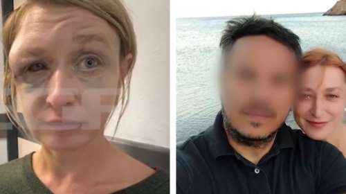 Κορωπί: "Δεν νομίζω να με χτύπησε ο σύντροφός μου, κακώς τον συνέλαβαν" - Η 40χρονη "αθωώνει" τον 50χρονο