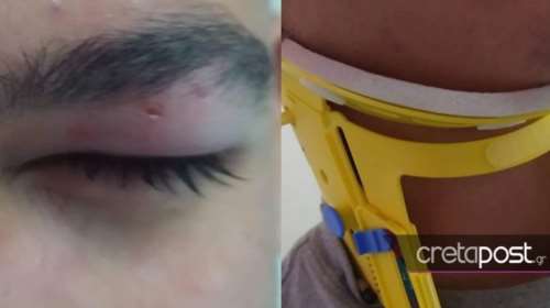 Νταής κρητικός οδηγός δεν σταμάτησε σε διάβαση και έσπασε στο ξύλο μαθητή που του έκανε παρατήρηση