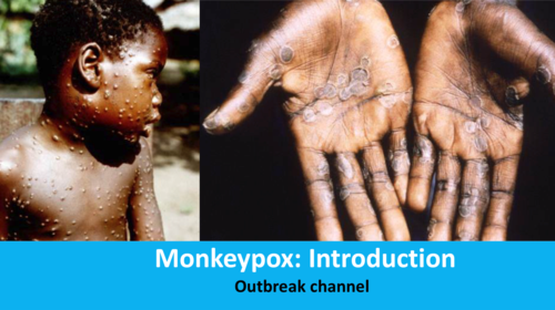 Ευλογιά των πιθήκων: Καθησυχάζει ο ΠΟΥ - Δεν υπάρχει φόβος ότι θα εξελιχθεί σε πανδημία