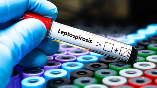 Συναγερμός στη Κέρκυρα για δύο κρούσματα λεπτοσπείρωσης - Στη ΜΕΘ νοσηλεύεται ο ένας