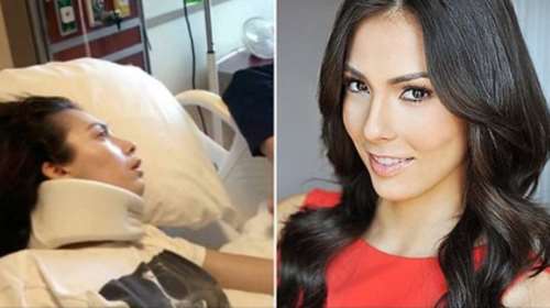 Η 27χρονη καλλονή που έμεινε παραπληγική μετά από μια μπουκιά πρέτζελ -  Αποζημίωση μαμούθ 29.5 εκατ. δολαρίων