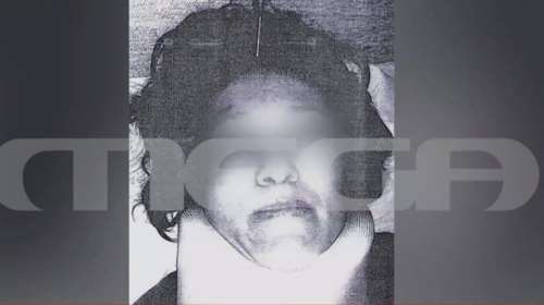 &quot;Φοβάμαι ότι θα με αποτελειώσει&quot;: Συγκλονίζει η 38χρονη που δέχτηκε επίθεση με βαριοπούλα από τον σύζυγό της [Βίντεο]