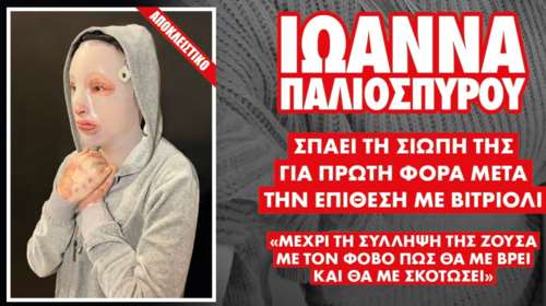Επίθεση με βιτριόλι: Συγκλονίζει η γιατρός της Ιωάννας - Με ειδική μάσκα και ειδικό ένδυμα σε όλο της το σώμα [Βίντεο]