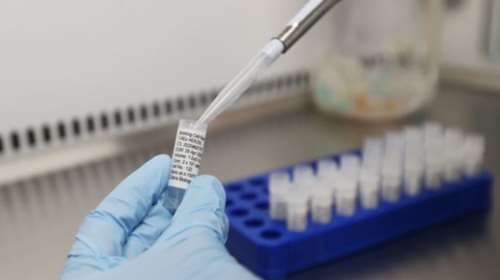 AstraZeneca: Από το επόμενο καλοκαίρι η φαρμακευτική εταιρεία θα έχει κέρδη