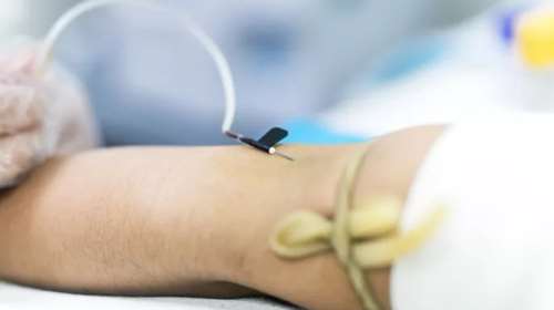 Καρκίνος του παγκρέατος: Πώς μια απλή αιμοληψία μπορεί να δώσει έγκαιρη διάγνωση;