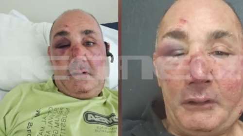 Ρόδος: Σοκάρει η άγρια επίθεση και ληστεία σε κοσμηματοπώλη - &quot;Έλεγα ότι θα πεθάνω&quot; [βίντεο]