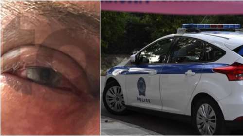 Γλυφάδα: Συνελήφθη ο Ισραηλινός για τον ξυλοδαρμό του επιχειρηματία στο εστιατόριο - Αρνείται ότι του χρωστάει λεφτά